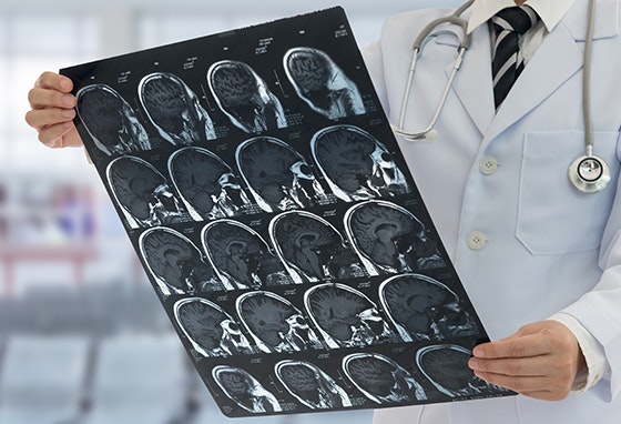 Acidente Vascular Cerebral. Faça um rastreio no nosso Centro.